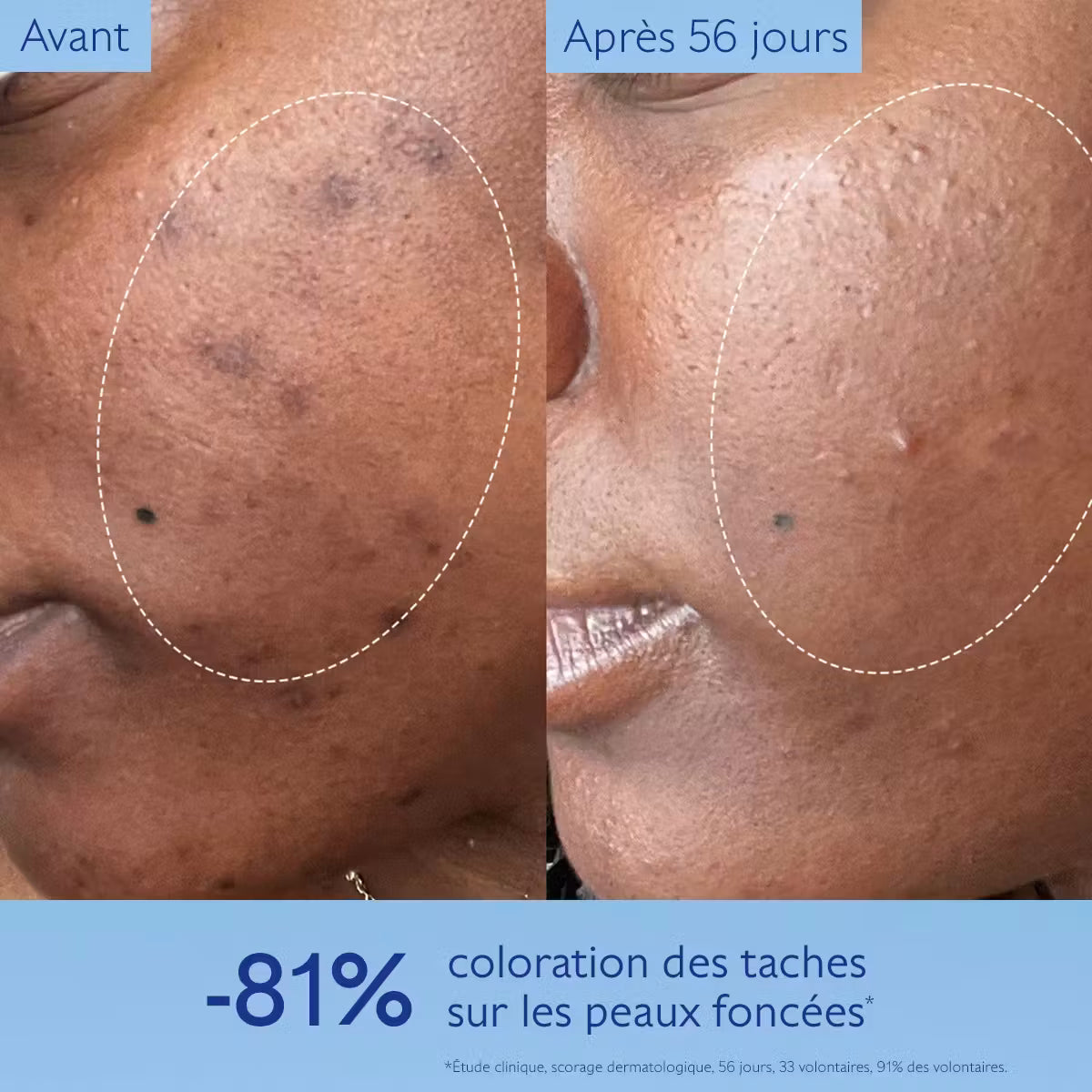 Caudalie Sérum Anti-taches Éclat - Vinoperfect 50ML