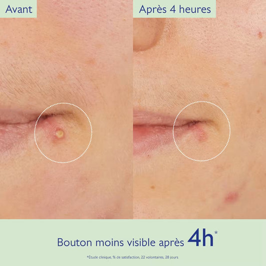 Caudalie Vinopure Stop Boutons 15 ml