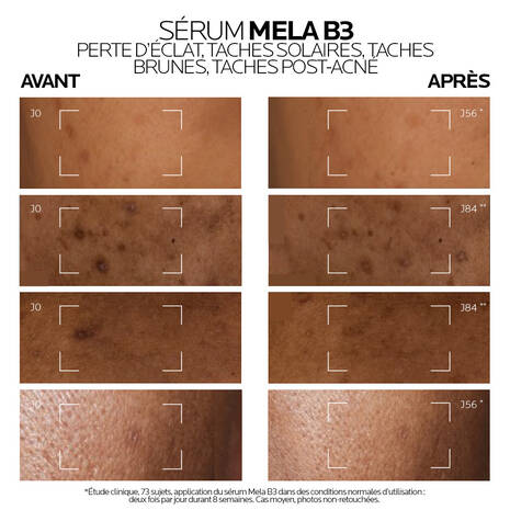 La Roche Posay Mela B3 Sérum anti-taches concentré intensif