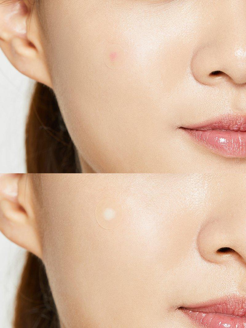 COSRX Acne Pimple Master Patch p/24